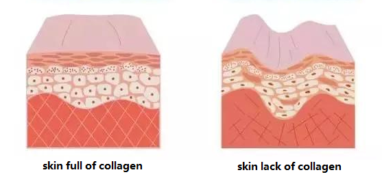 skin comparation